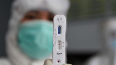 Perlu Tahu! Ini Perbedaan Rapid Test dan RT-PCR